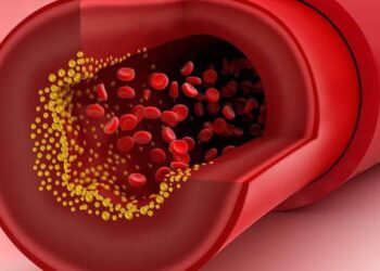 نوع من الطعام يساهم في خفض نسبة الكوليسترول الضار بنسبة تصل إلى 70٪ ويقي من أمراض القلب