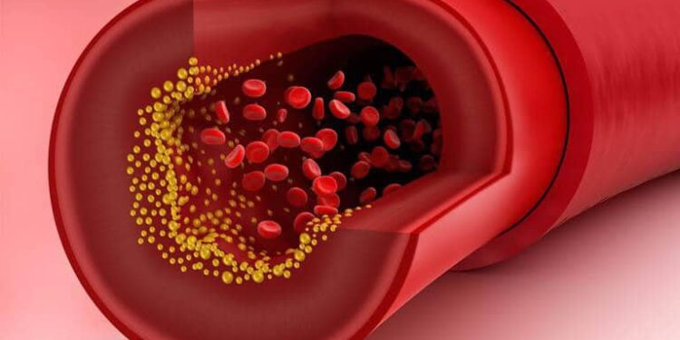 نوع من الطعام يساهم في خفض نسبة الكوليسترول الضار بنسبة تصل إلى 70٪ ويقي من أمراض القلب