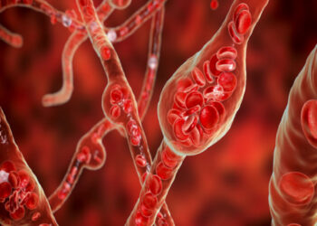 علامات تحذيرية لارتفاع الكوليسترول وأسبابه الشائعة