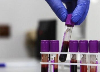 الصحة الروسية تسجل دواء مناعيا مبتكرا لعلاج سرطان الرئة سينتج محليا بالكامل