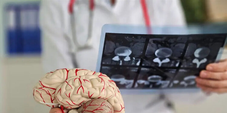 بروتين قد يحمي الدماغ من مرض الزهايمر.. اليكم آخر ما توصل اليه العلماء