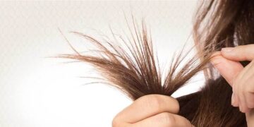 هذا السبب وراء تساقط الشعر ومشاكل الفروة عند النساء!